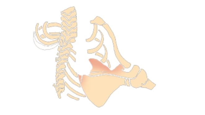 Reducing pain and injury risk in golfers
